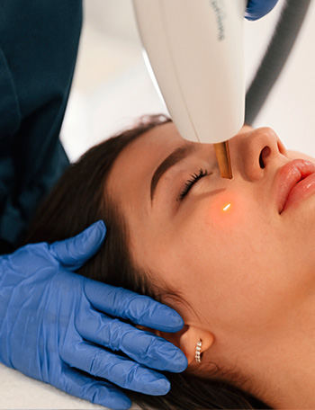 1450nm Diode Laser for Acne Treatment ā thumbnail