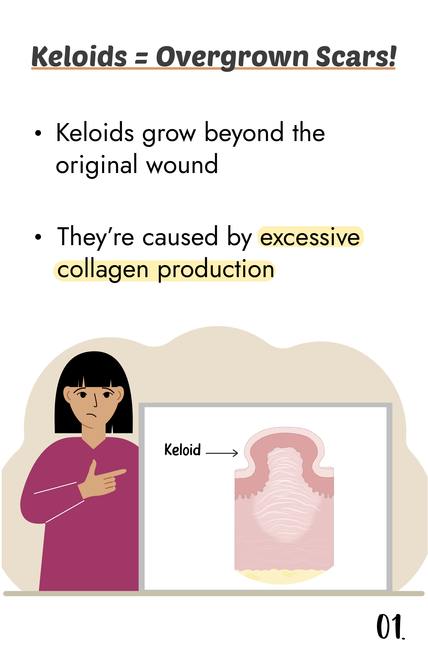 keloid_causes