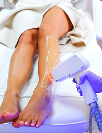 Laser Hair Removal Treatment — thumbnail