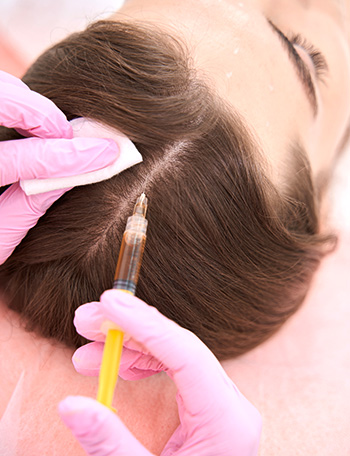What is PRP Hair Treatment? — thumbnail