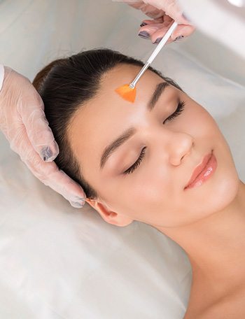 Salicylic Acid Peels for Stubborn Acne — thumbnail